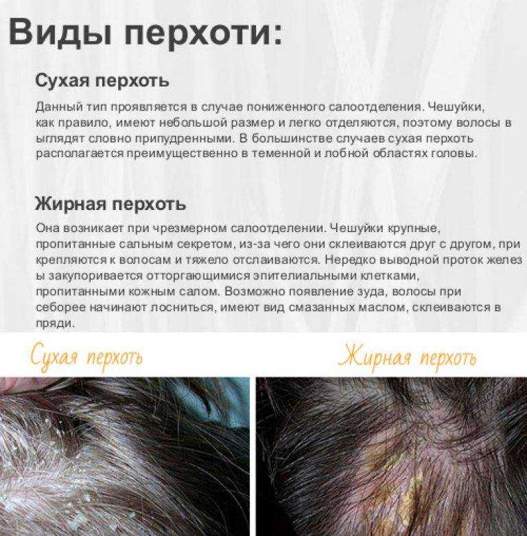 Псориаз волосистой части головы: особенности диагностики и терапии :: статьи и доклады