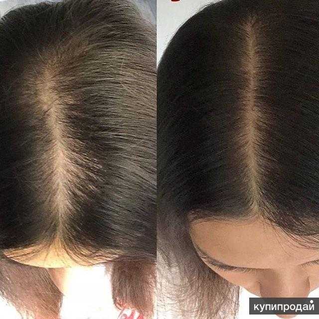 Капсульное наращивание волос: фото до и после, сколько стоит и какие виды бывают, плюсы и минусы