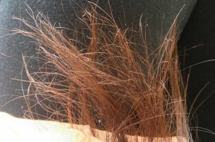 Обзор лучших средств для кончиков волос. как ухаживать за кончиками волос в домашних условиях