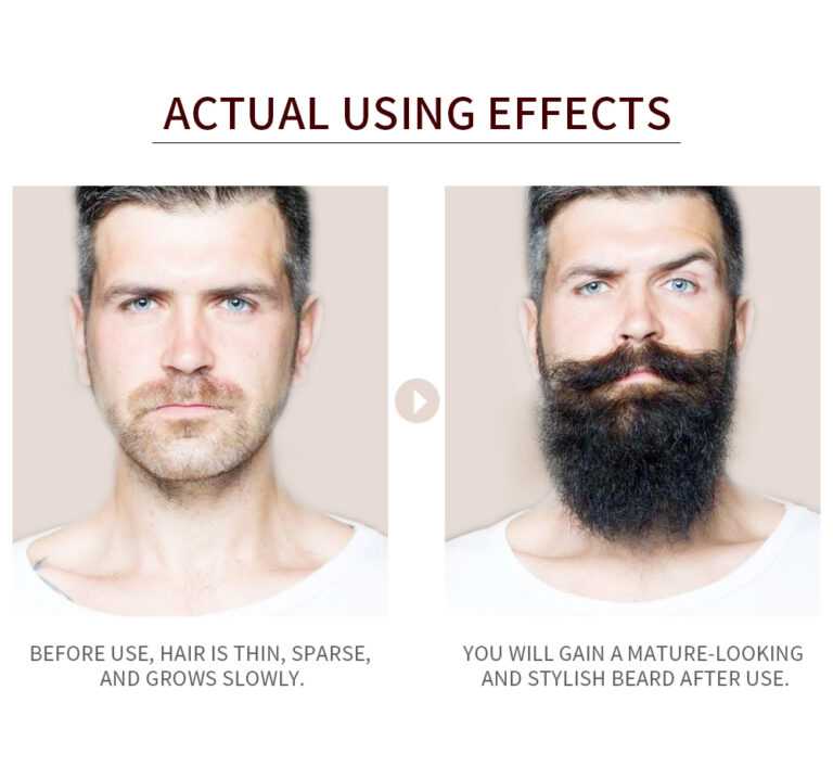 Как отрастить бороду, полезные советы от эксперта