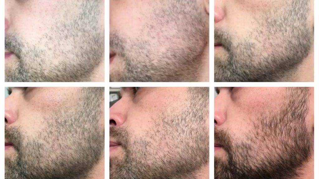 Как отрастить густую бороду: практические советы