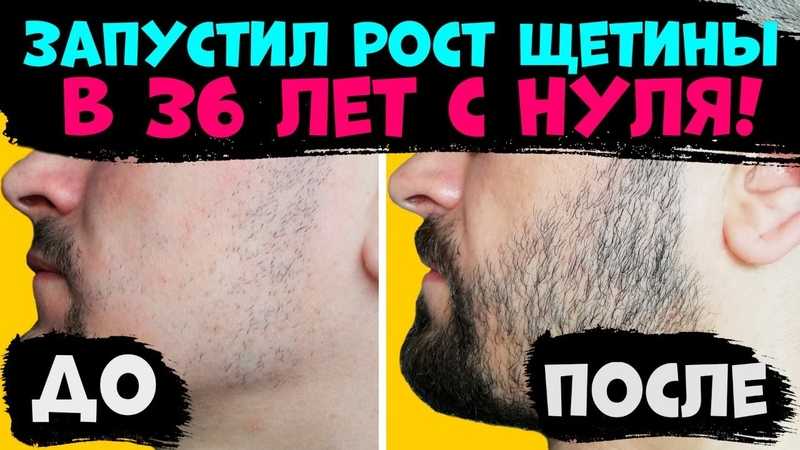 5 причин, почему ты не можешь отрастить бороду (это исправимо?)