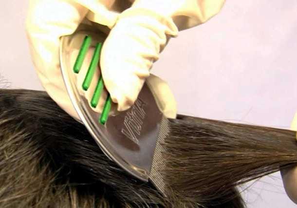 Как вычесать гнид с длинных волос: как правильно, быстро и чем это сделать, техника вычесывания вшей, видео, зачем нужно это сделать после обработки у человека