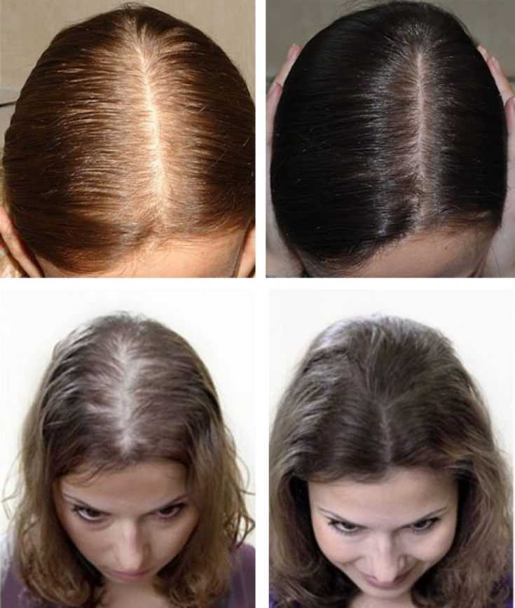 Капсулирование волос: что это такое и можно ли сделать в домашних условиях