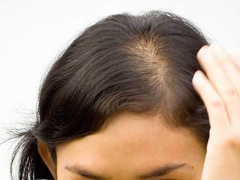 Выпадение волос летом: как с этим бороться?