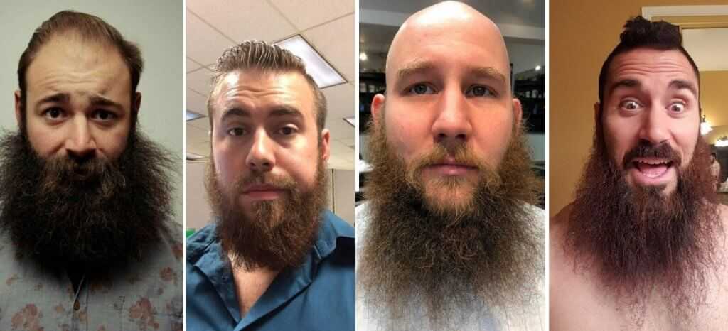Как долго отрастает борода и что влияет на ее рост