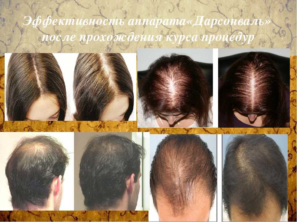 Аппарат для восстановления волос “molecule professional”. отзывы | otzomir.com