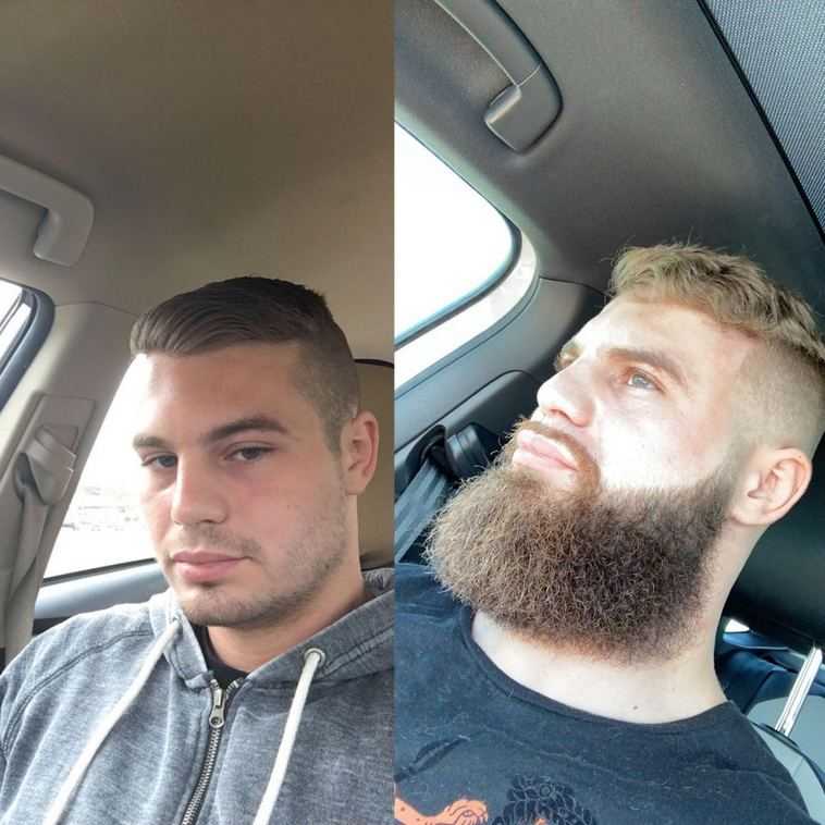 Как замедлить рост волос после бритья - dorco.ru