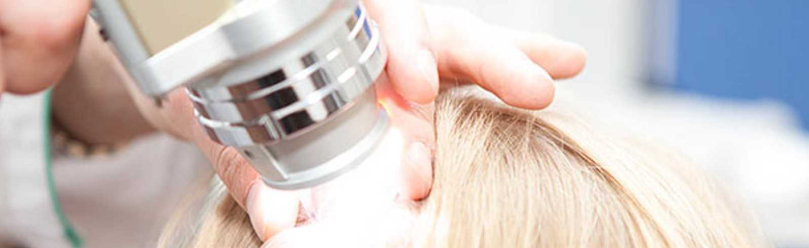 Пересадка волос на лоб (лобная зона)
