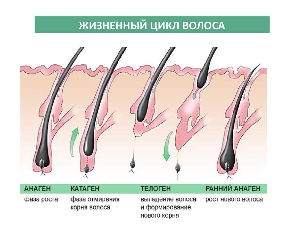 Миноксидил – безусловный активатор роста волос :: врачам-специалистам