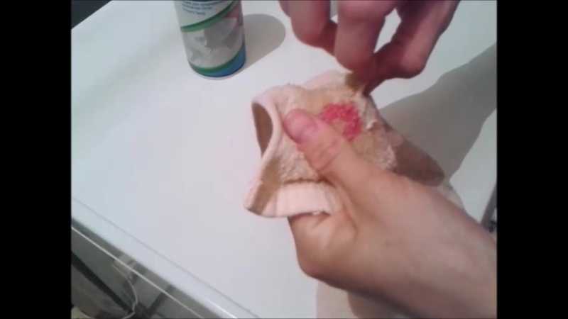 Как убрать жвачку с кожи: как удалить прилипшую жевательную резинку, чем оттереть оставленные ею следы?