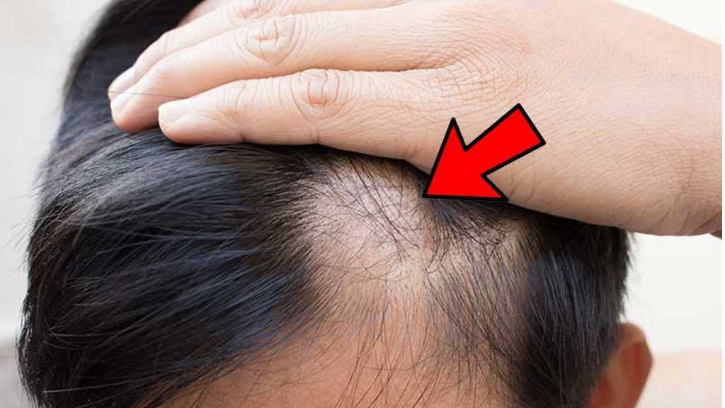 Ранняя седина у мужчин: причины и возраст появления седых волос