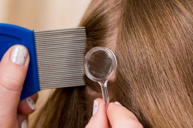 Какие инструменты понадобятся для вычесывания вшей и гнид с волос человека Другие средства от педикулеза Подготовка к вычесыванию Периодичность вычесывания