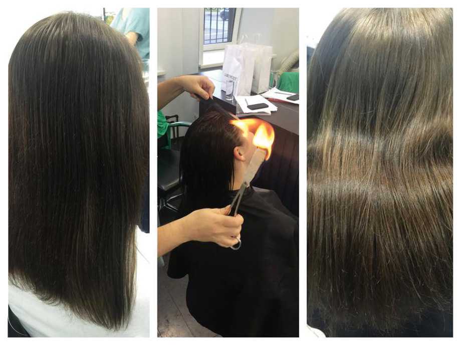 Выпадение волос после химиотерапии. новые методы восстановления