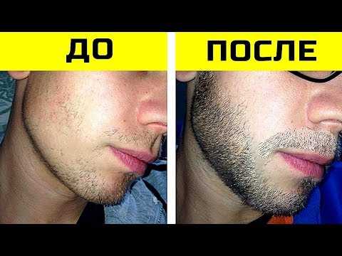 Можно ли ускорить процесс роста бороды?
