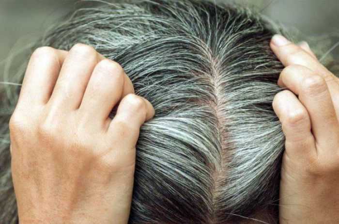 Как остановить поседение волос, лучшие медицинские и народные методы