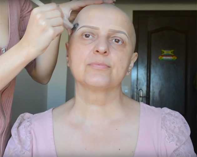 Как справиться с побочными эффектами химиотерапии | memorial sloan kettering cancer center