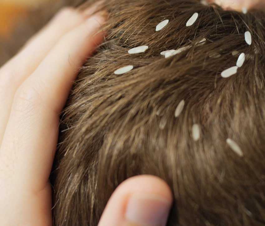 Жирные волосы у корней: что делать, как избавиться, уменьшить и быстро убрать жирность у основания волос при сухих кончиках, шампунь, маски и другие средства