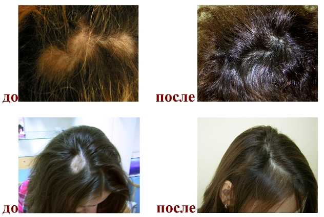 Сатура роста (satura rosta) для волос — ухаживаем за слабыми и выпадающими волосами
