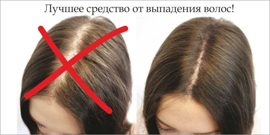 Как сделать так чтобы волосы были без пробора