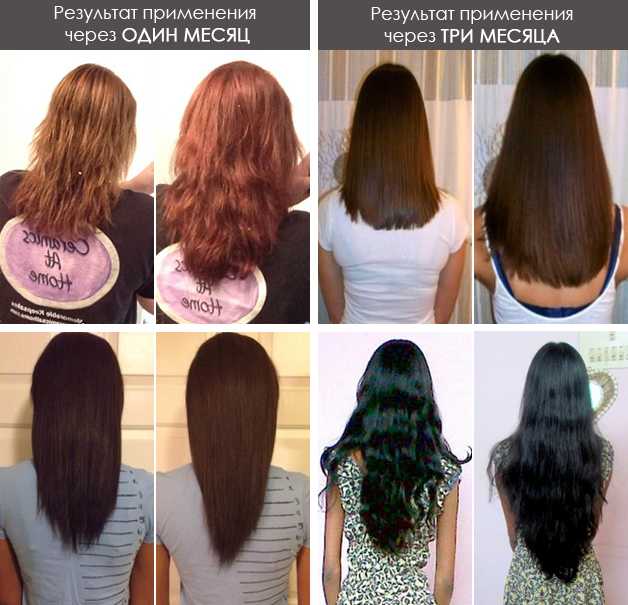Спрей для волос ultra hair system: отзывы, свойства и состав препарата | volosomanjaki.com
