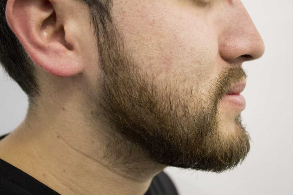 Как долго отрастает борода и что влияет на ее рост
