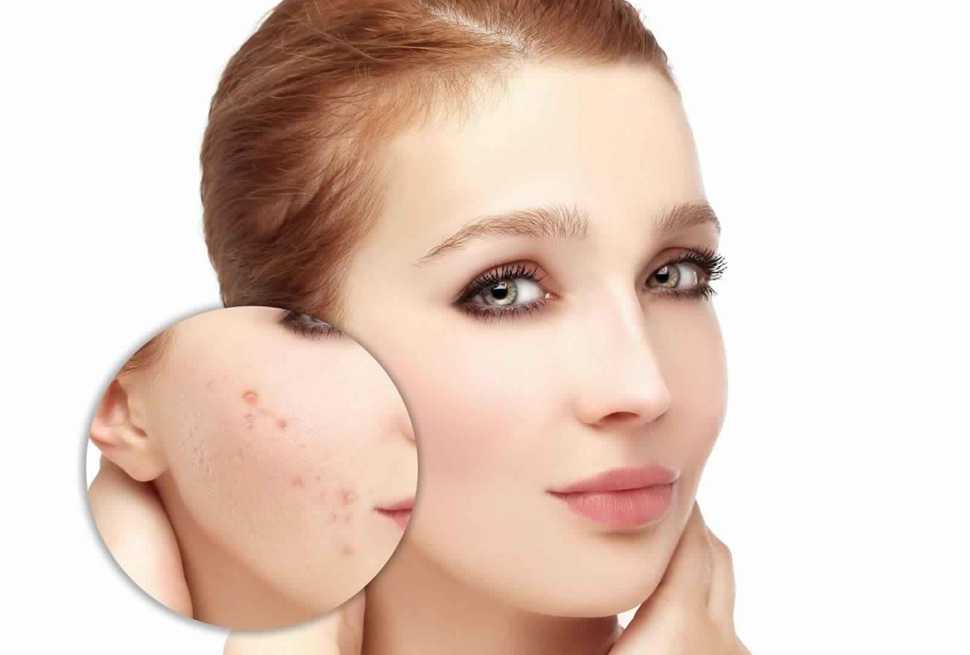 Распространенные заболевания кожи головы: дерматологические, грибковые, гнойничковые, инфекционные
