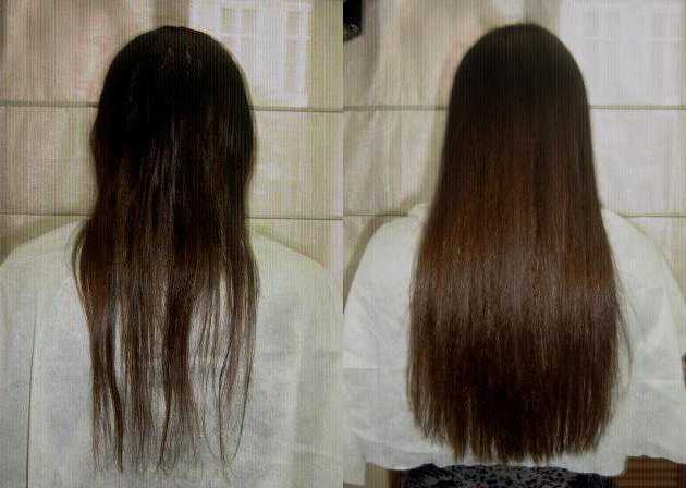 Выпадение волос после химиотерапии. новые методы восстановления