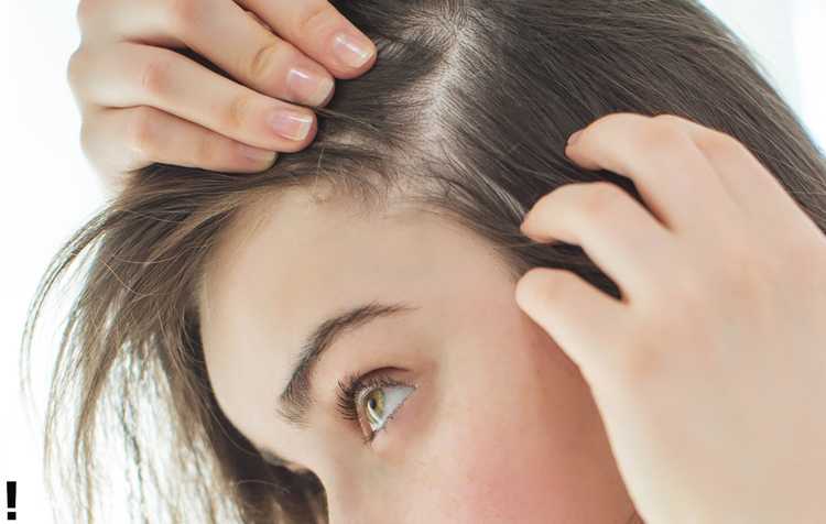 Выпадают волосы у женщины: что делать? – публикации – лаборатория ан-тек