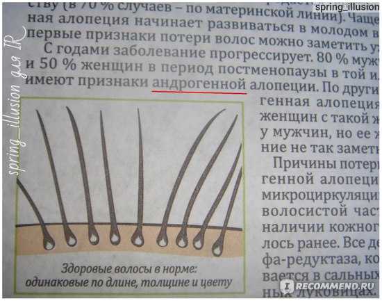Маска русское поле с экстрактом жгучего перца для роста волос — доступное средство для быстрого роста