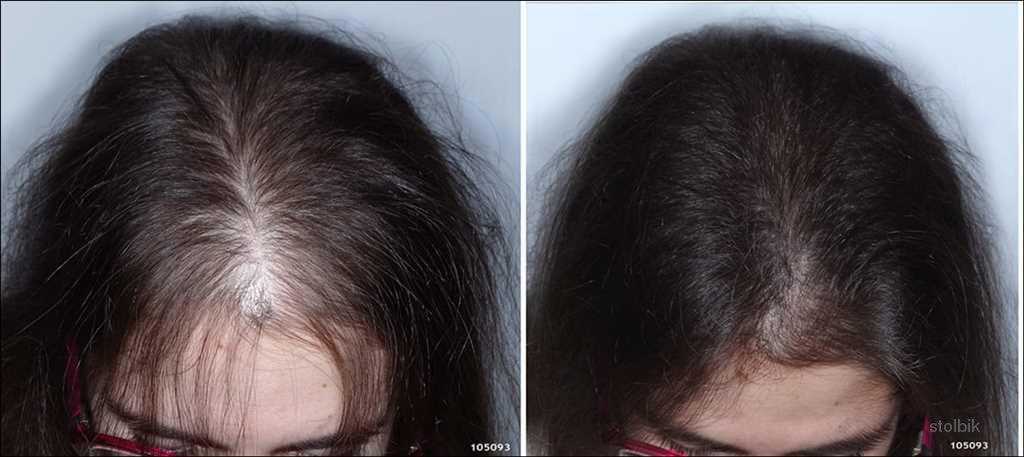 Восстановление волос после covid-19: что делать? - косметология доктора корчагиной