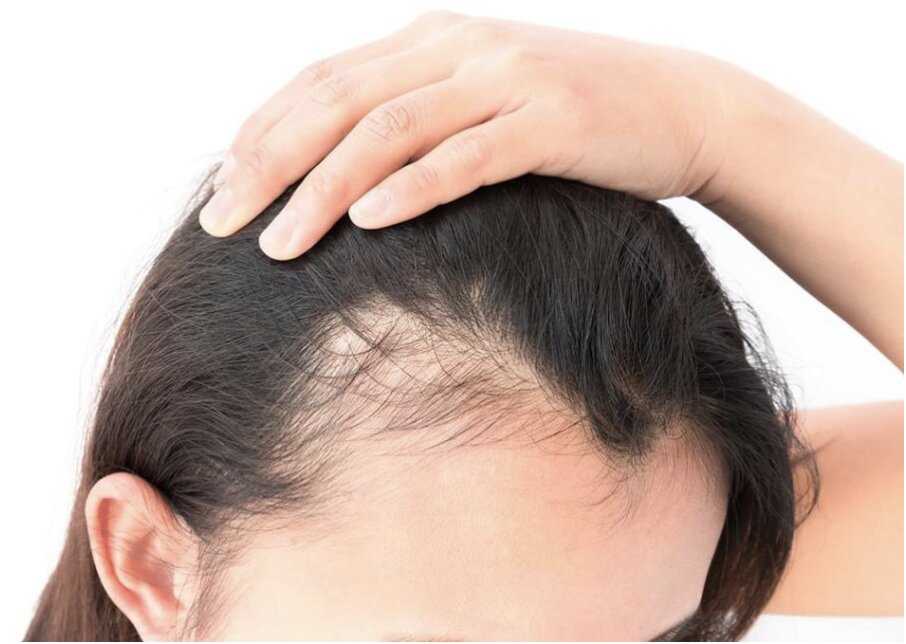 Диксон полипант — ампулы от выпадения и для роста волос | bellehair.info