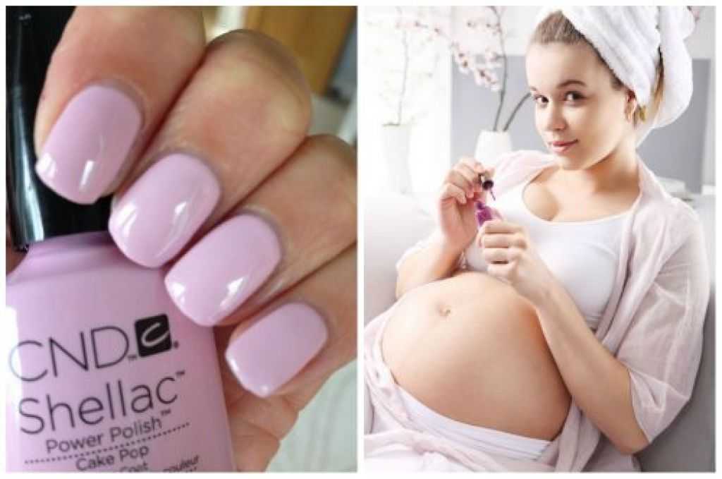 Можно ли беременным наращивать ногти - советы эксперта