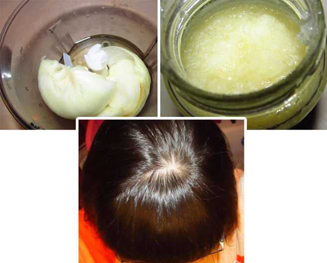 Маски для волос из лука — рецепты для роста и от выпадения