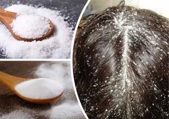 Маски для волос с кокосовым маслом: 7 рецептов восстановления волос