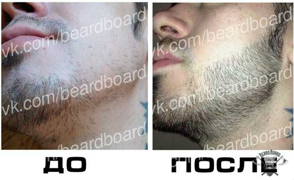 Мужские бороды: формы и варианты бороды с усами и без 30 фото