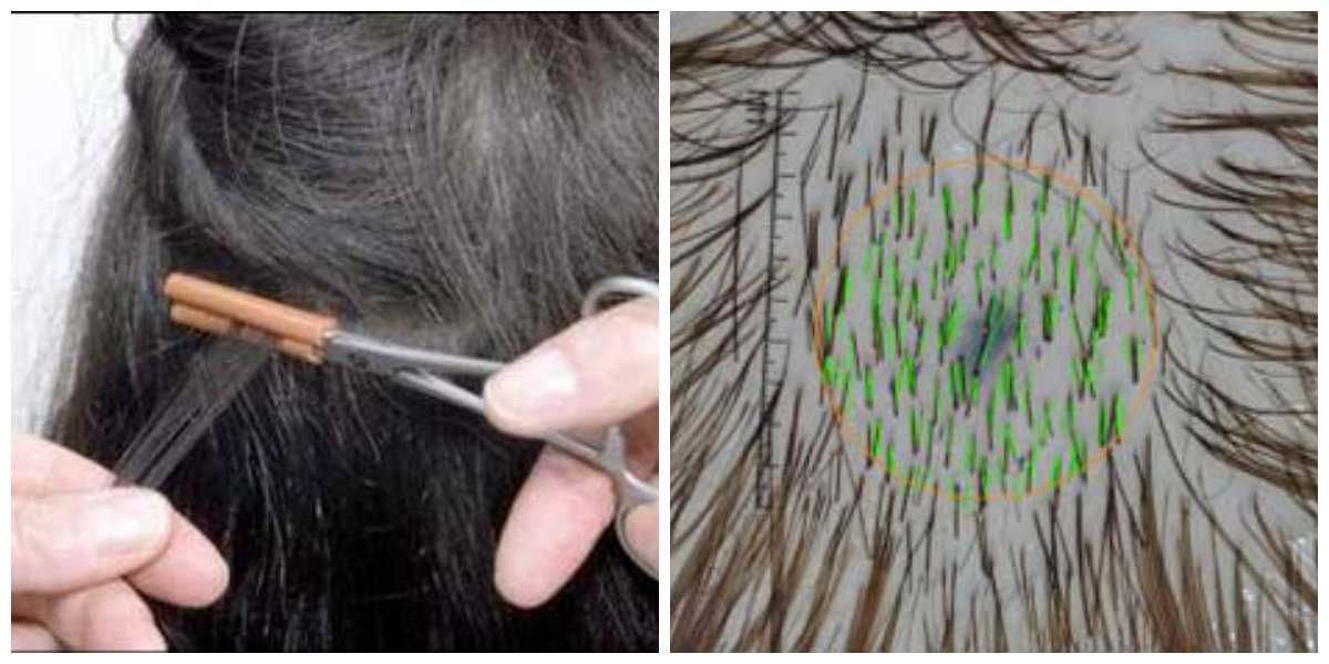 Пористые волосы - причины, лечение и уход за пористыми волосами