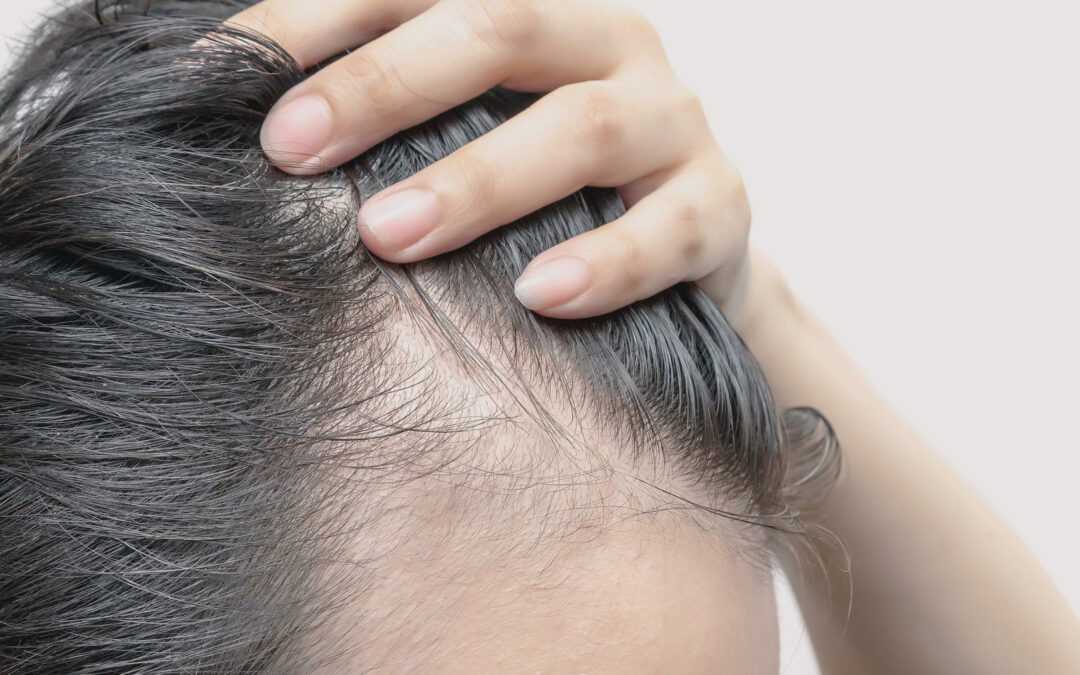 Почему седеют волосы и можно ли с этим бороться? объясняет врач-трихолог. «бумага»