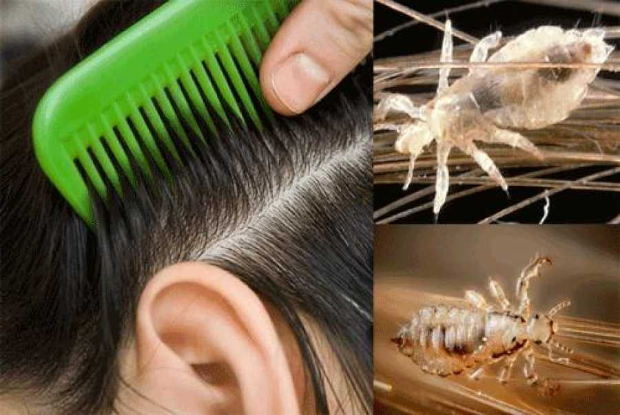 ❶ как вычесать гнид с длинных волос в домашних условиях