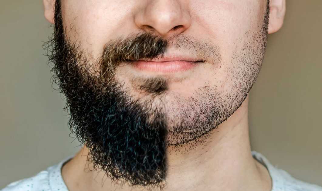 Расскажем о кудрявой бороде: особенности, кому идет и как правильно ухаживать Фото с пошаговой инструкцией: как распрямить вьющиеся волосы на лице Советы экспертов