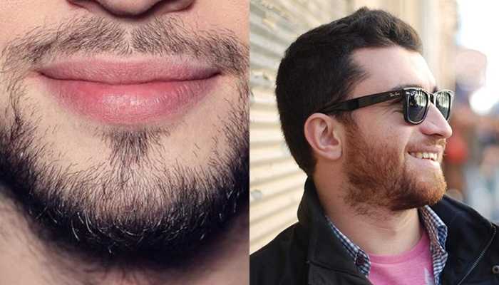 Как отрастить бороду как у иисуса