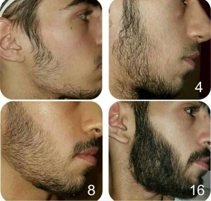 Реально ли быстро отрастить бороду в 15 лет