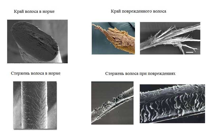 Секущиеся волосы фото под микроскопом