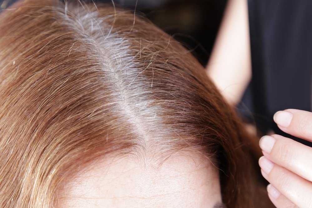 Опасно ли вырывать седые волосы, что может произойти и есть ли альтернатива борьбы с сединой | bellehair.info