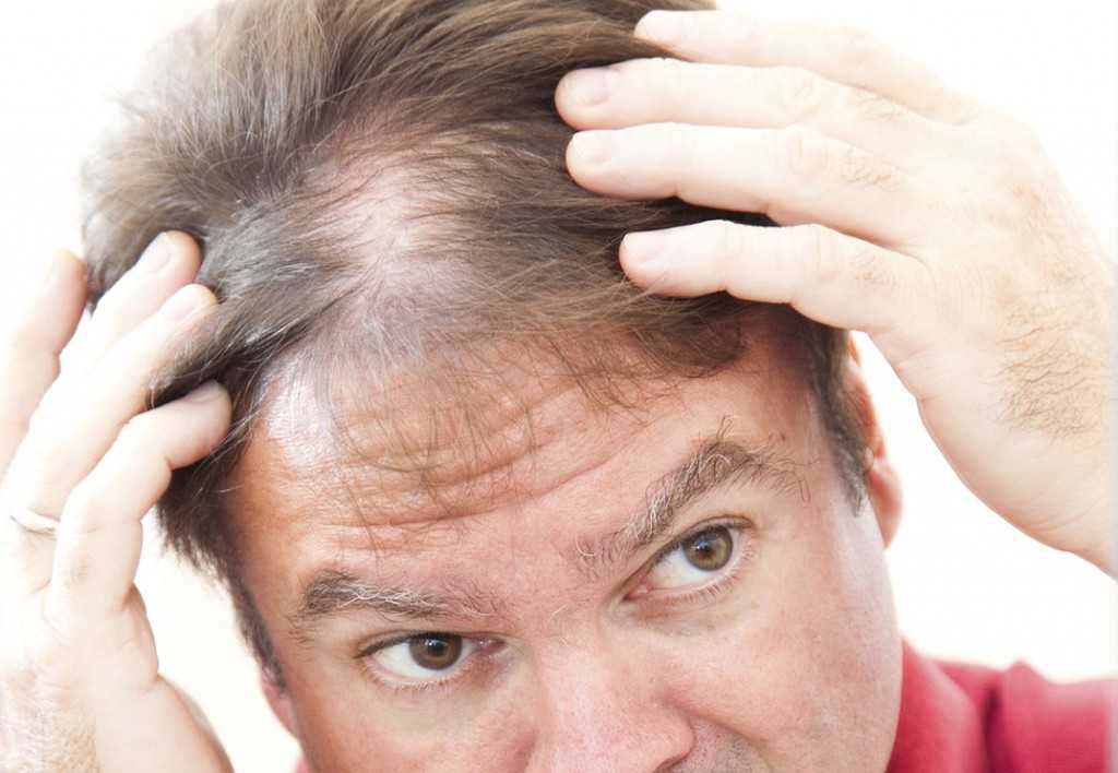 Почему седеют волосы и можно ли с этим бороться? объясняет врач-трихолог