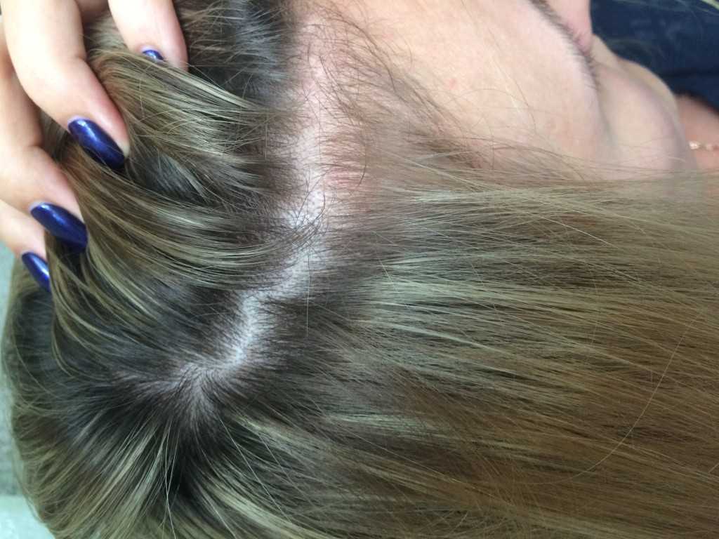 Как вернуть свой цвет волос после окрашивания
