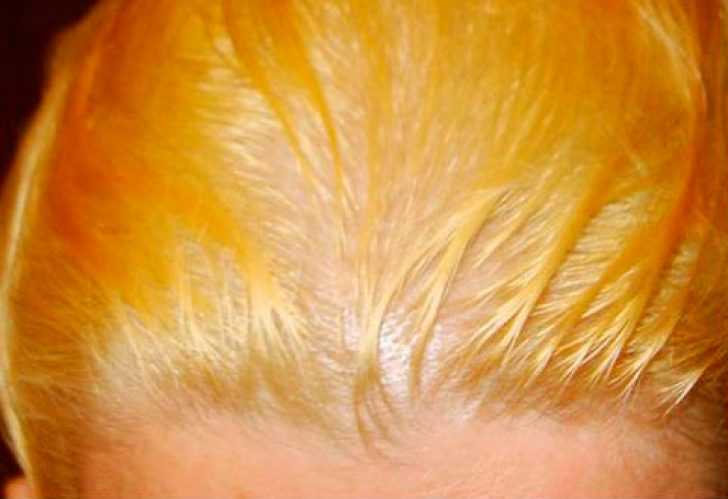 Осветлитель для волос без желтизны: чем лучше осветлить в домашних условиях, лучшая осветляющая краска, отзывы, чем обесцветить