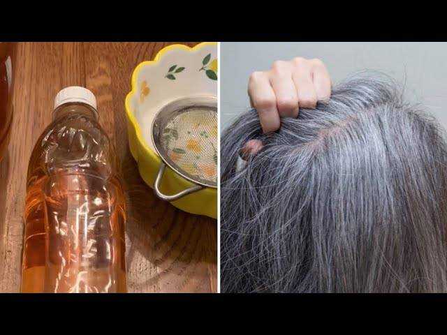 Как можно избавиться от появления седых волос Удастся ли восстановить прежний цвет прядей: лечение в салоне, медикаменты и народные способы