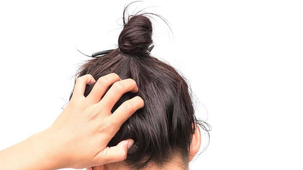 Что такое грибок волос и как лучше от него избавиться
    
    | клиника меди лайф