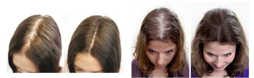 Капсулирование — подготовка волос к наращиванию горячим методом О том как происходит этот процесс вы узнаете в этой статье